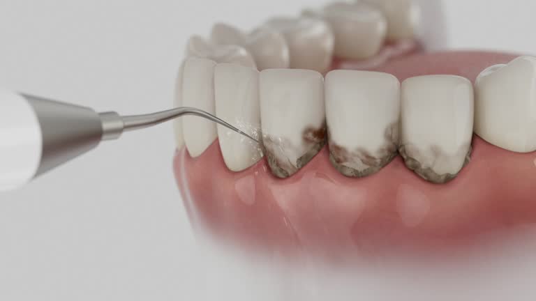 Trusted Tooth Extraction service in Bethany, OK - Dentist Open Now